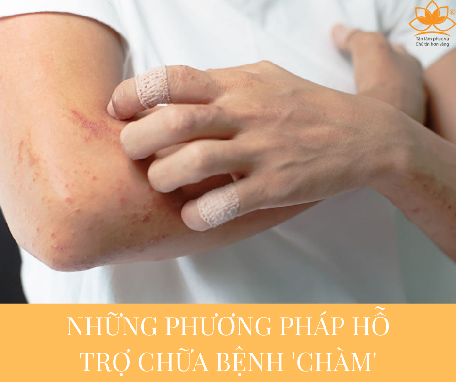 CÁCH ĐIỀU TRỊ DỨT ĐIỂM BỆNH 'CHÀM'